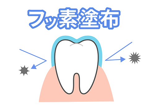 歯質を強くする